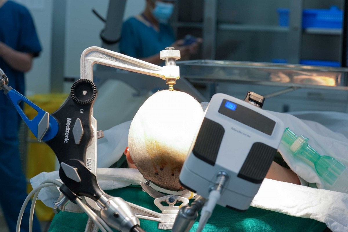 Vinmec Central Park mở lối đi mới trong điều trị động kinh bằng công nghệ Robot đỉnh cao